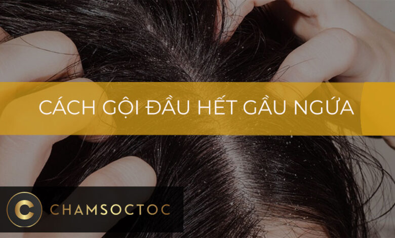 Cách gội đầu hết gầu ngứa