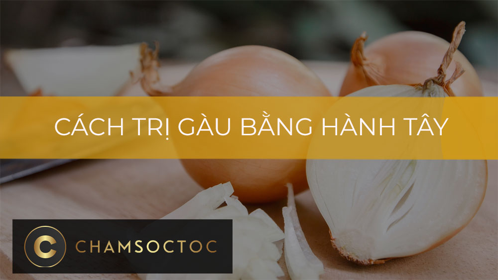 Cách trị gàu bằng hành tây