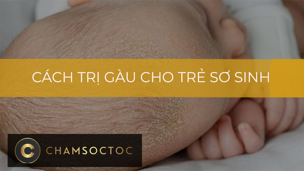 Cách trị gàu cho trẻ sơ sinh