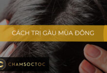 Cách trị gàu mùa đông