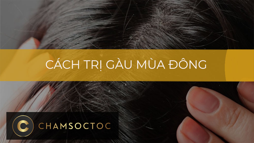 Cách trị gàu mùa đông